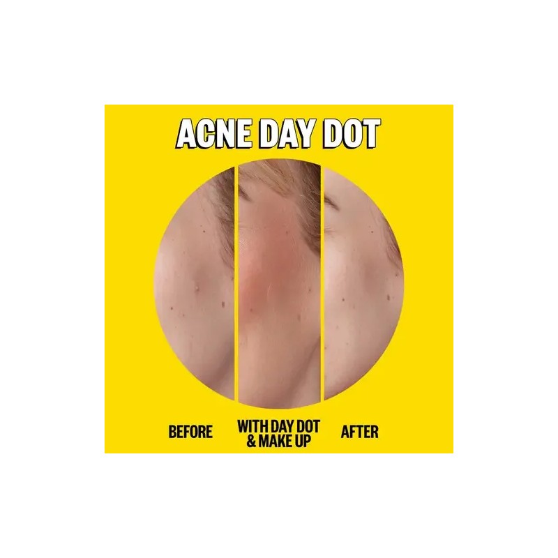 Peace Out Skincare Acne Day Night Duo Parches De Espinil