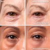 It Cosmetics Bye Bye Under Eye Bags - Tratamiento Antiedad