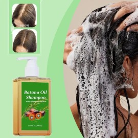 Batana Oil Shampoo, Shampoo De Batana, Rosemary Oil Shampoo