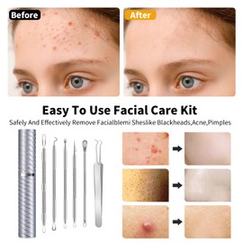 Goooxtex Pimple Popper Tool Kit Blackhead Remover Comedone Extractor Kit with Box for Quick and Easy Removal of Pimples, Blackheads, Zit on Face - Acne Removal Kit 6 Pcs (Silver)