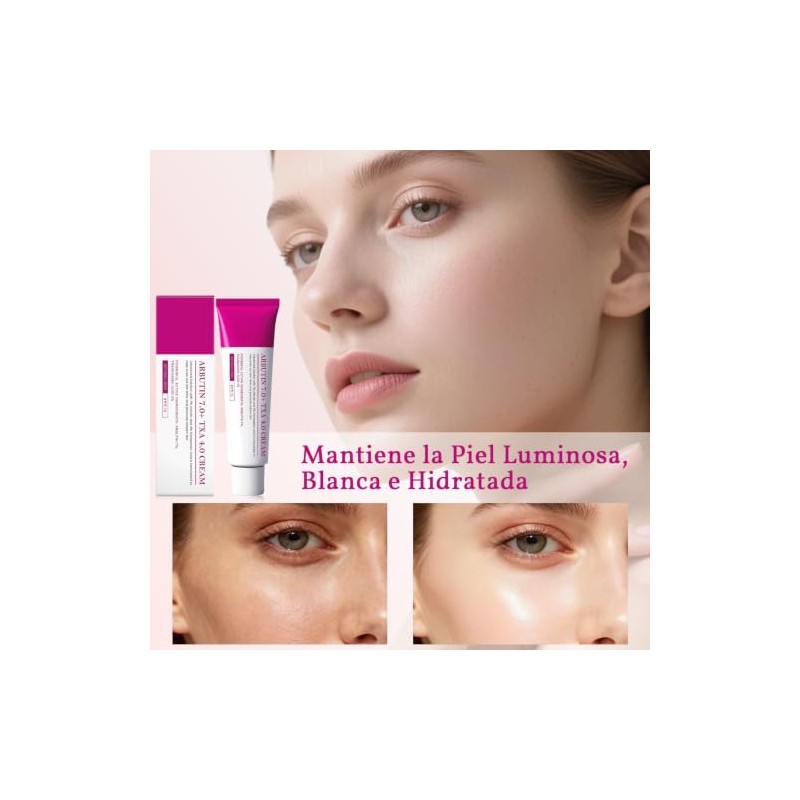 Arbutin 7.0 + TXA 4.0 Cremas Manchas Faciales, Reduce la