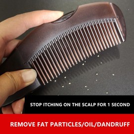 비듬 제거 헤어 빗 도구 정전기 청소 브러쉬 방지 마사지 자체 드레싱 스타일링 [Y2] Dandruff Removal Hair Comb Tool Anti-static Cleaning Brush Prevention Massage Self-dressing Styling [Y2]