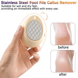 SJWOW Stainless Steel Foot File Callus Remover Double Sided Egg-Shaped Foot Rasp Scrubber Metal Pedicure File Softly Remove Tough Calluse to Reveal Smooth Feet Suitable for Men and Women (White)