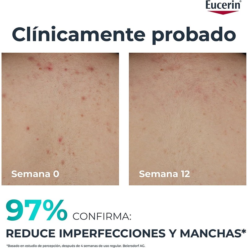 EUCERIN DermoPure Triple Effect Crema Corporal (200ml) Anti-Imperfecciones, Anti-Manchas, Anti-Brillo,