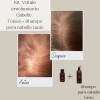 Paquete Tónico Y Shampoo Para Cabello Lacio Tónico Vittale