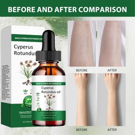 Cyperus Rotundus Oil - Nut Grass Extract, 60ml Body Skin Nurturing Serum for Gentle Care