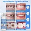 Reparación Dentaduras, Dientes Postizos Moldeables Reutilizables, 30ml | Diente provisional