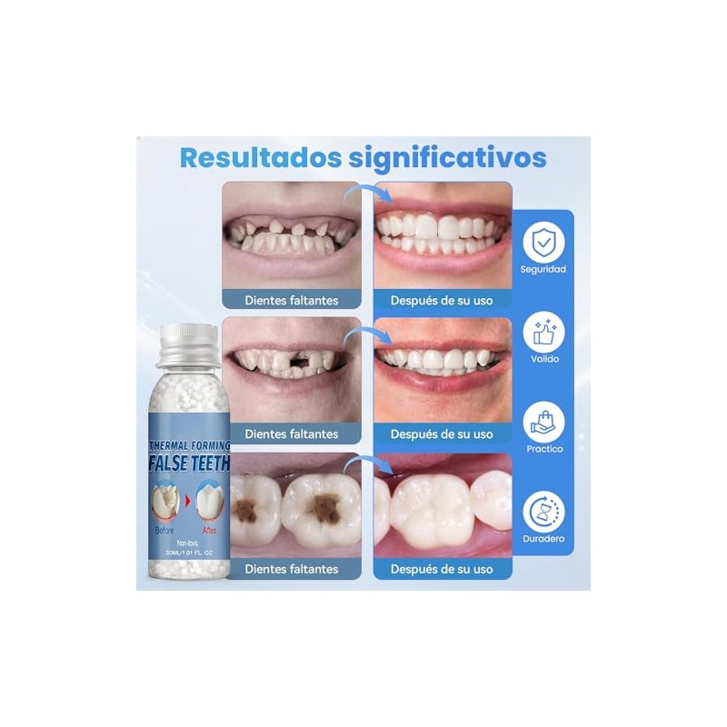 Reparación Dentaduras, Dientes Postizos Moldeables Reutilizables, 30ml | Diente provisional