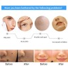 Ultrasonic Freckle Spots Removal Machine Detoxifying Face Care Machine for