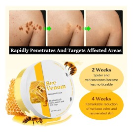 Fg Crema De Lactancia Para La Piel, Eficaz Para Reducir Lasm