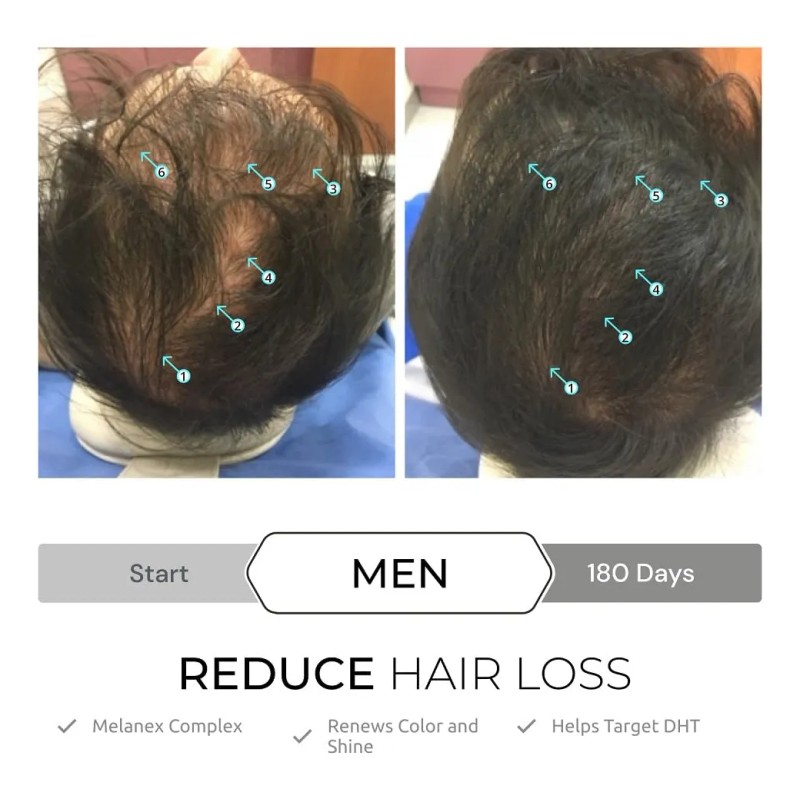 Sérum Capilar Ds Laboratories Spectral.dnc-s Hair Growth 5%