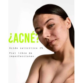 Serum Sebo, Tratamiento Control Y Eliminación Deacné.
