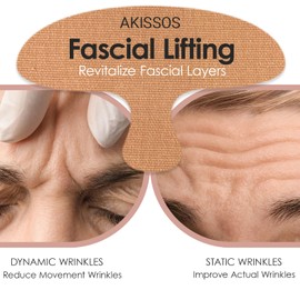 Forehead Wrinkle Patches Overnight (15 Pack) - Deep Wrinkle Repair from Fascia Layer,Micro Lift Elastic Facial Patches, Face Tape for Sleeping, Hypoallergenic Elasticity Cotton for Forehead Firming