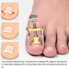 2 Piece Set Ingrown Toenail Correction Strips Brace Kit Ingrown