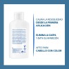 Ducray Kelual Ds Shampoo Cuidado Para Caspa Severa 100ml