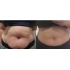 Rema's Secrets Seaweed Dead Sea Body Wraps Fat Melting Lipo