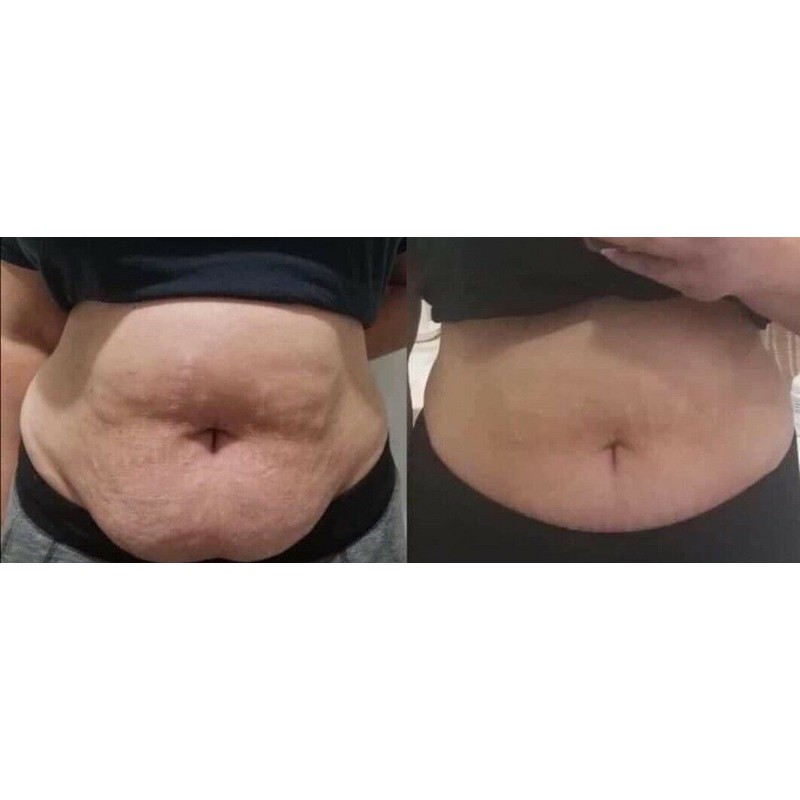Rema's Secrets Seaweed Dead Sea Body Wraps Fat Melting Lipo