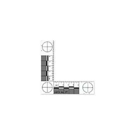 ABFO NO.2 Bitemark Scale
