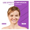 Cinta Transparente Anti Arrugas Elevación Facial Reafirmante