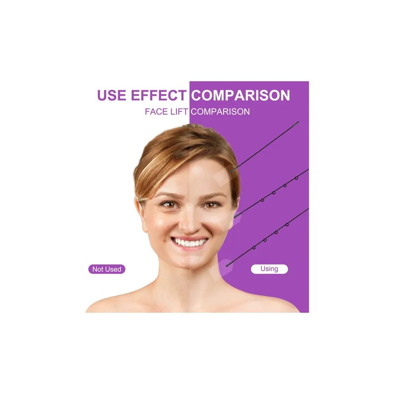 Cinta Transparente Anti Arrugas Elevación Facial Reafirmante