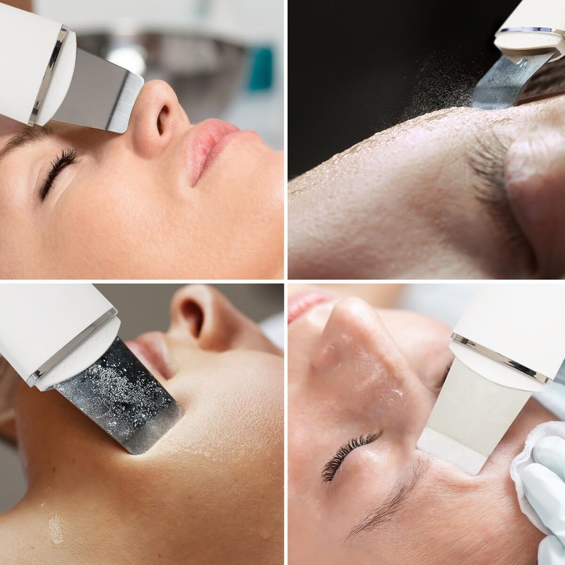 Rio Ultrasonic Skin Cleanser