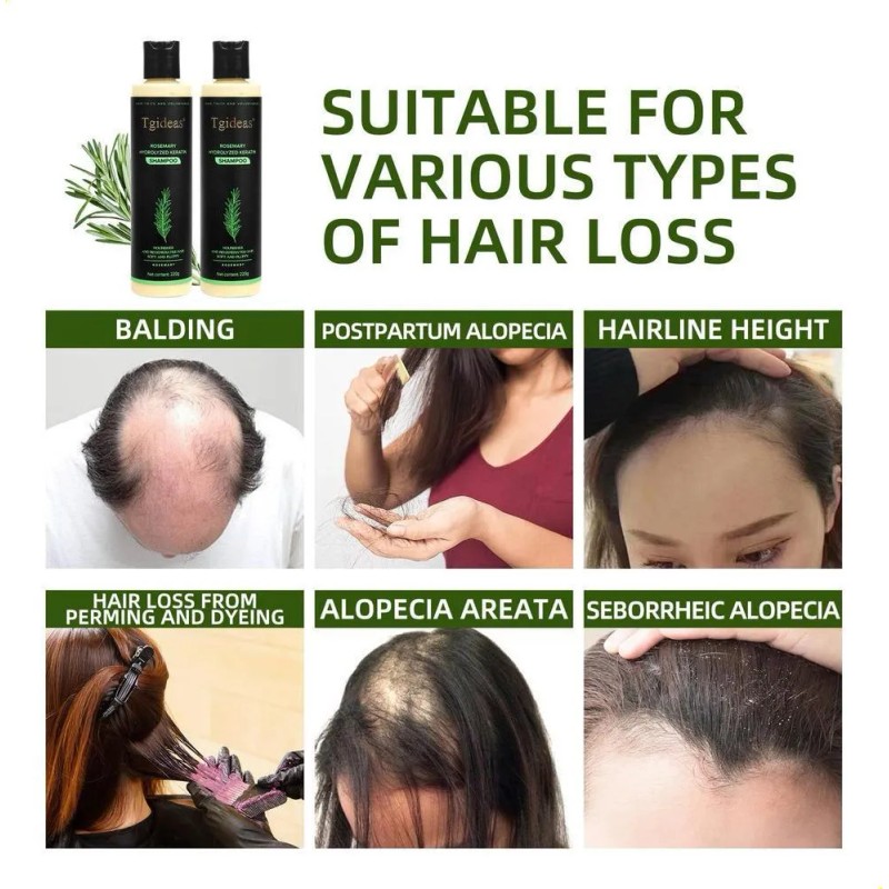 Champ Orgnico De Romero Ideas Para El Crecimiento Del Cab