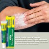 Crema De Psoriasis Para Varios Síntomas De Psoriasis 20g