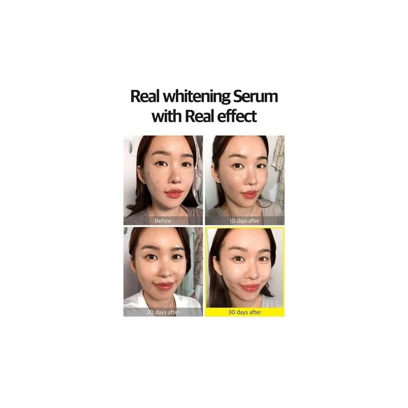 Some by Mi Yuja Niacinamida Sérum Anti Imperfecciones 50ml Rostro