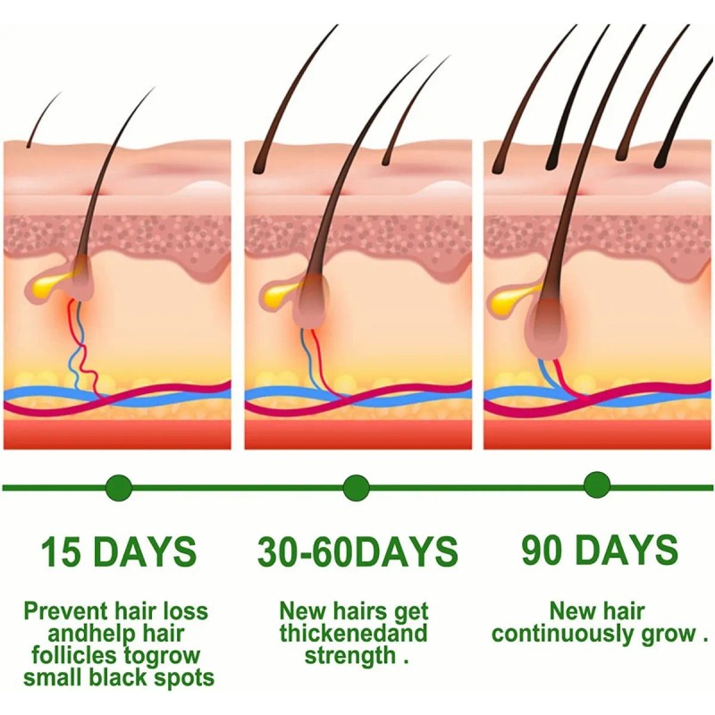 Sérum Para El Crecimiento Del Cabello 30ml Aceite De Romero