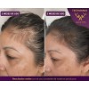 1 Shampoo Anticaída Y Crecimiento Chile Y Romero Vital Root