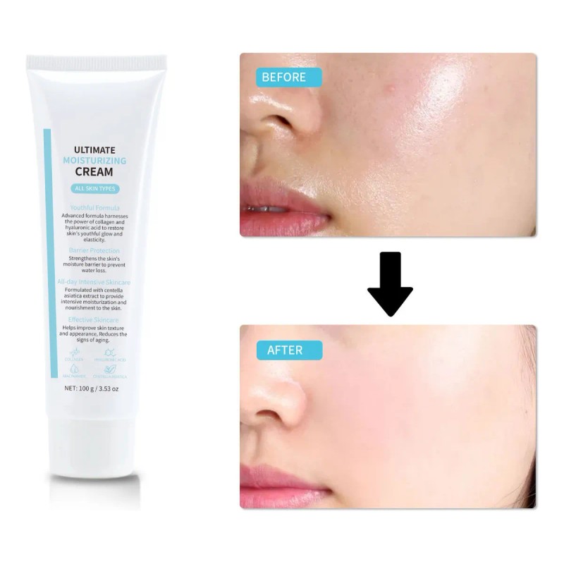 Crema Hidratante Ultimate - Colágeno +ácido Hialurónico 100g