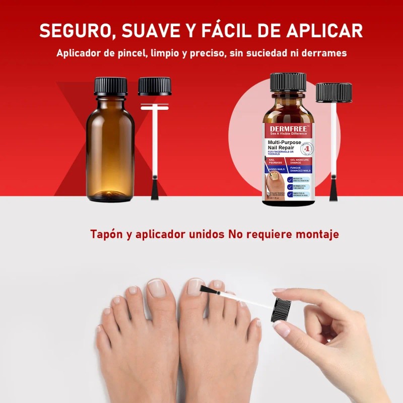 Fungicida Para Uñas Eliminar Hongos En Uñas De Manos Y