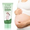 Stretch Marks Cream Prevent and Reduce Stretch Marks Pregnancy Safe