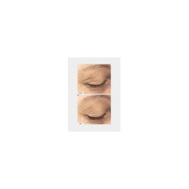 freezeframe Face Tight 30ml