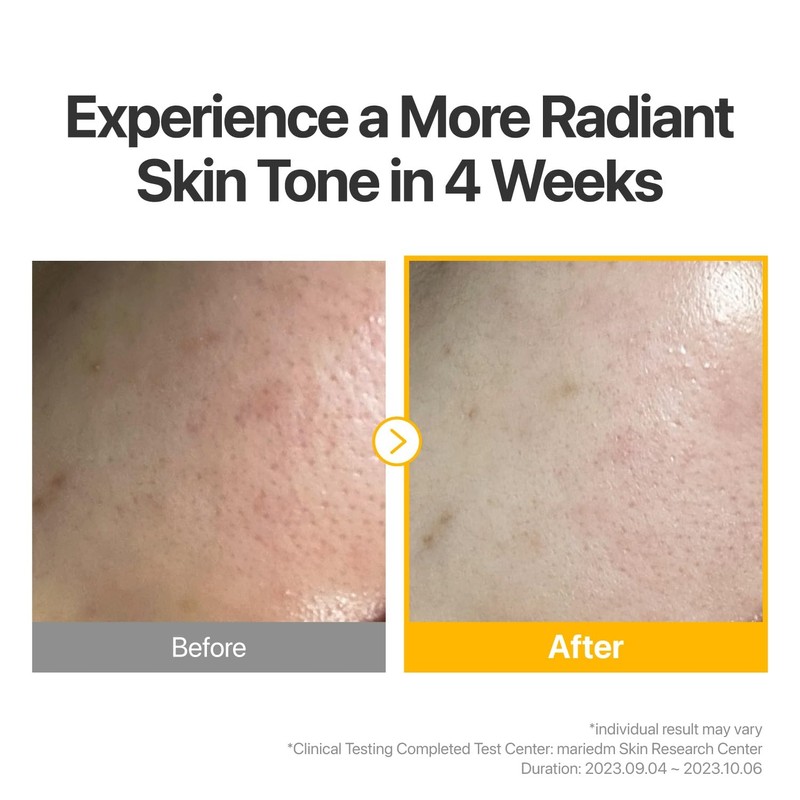Nubujin No. 5 Sheet Mask |Vitamin Spotlight Glutathione and C