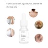 Generic Mild Hair Growth Inhibitor Serum,for Face, Arm, Legs Body
