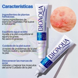 3pcs Crema Pure Skin Elimina Acné y Cicatrices Control De Grasa - 30gr c/u