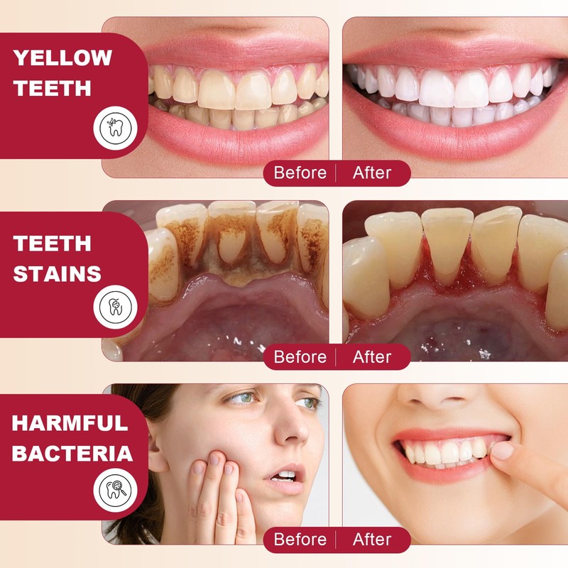 SP-6 Probiotics Whitening Toothpaste, with Probiotics Deep Cleaning Oral Care