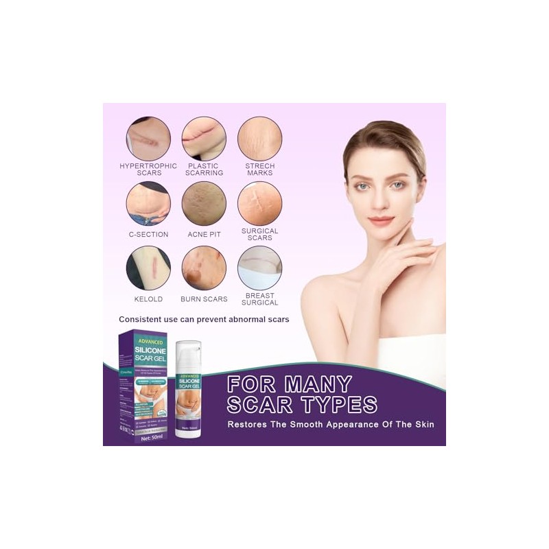 Crema De Silicona Para Cicatrices En Gel: Tratamiento Avanzado Para
