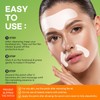 SILKDERMIS Forehead Wrinkle Patches 12Pcs with Smile Line Patches 24Pcs