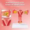 SimCoach Human Uterus and Ovary Anatomical Model, Female Reproductive Model
