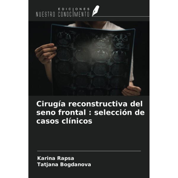 Cirugía reconstructiva del seno frontal : selección de casos clínicos