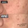 Kiehl's Super Multi-Corrective Face Cream - Crema Hidratante Antiedad