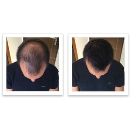 Caboki Hair Loss Concealer Trial Pack (Dark Brown)