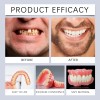 Set Pares Dientes Postizos Silicona Carillas
