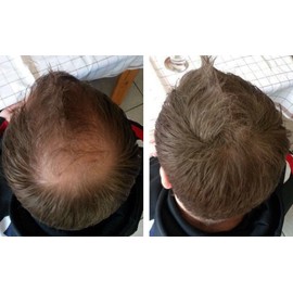 Plus Additional Hair, Effective Scatter Hair for Men and Women, Optical Hair Thickener for Light Hair with Vitamin E I Hair Filler Vegan, 1 x 25 g Can