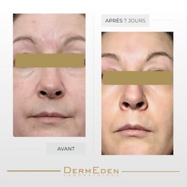 DERMEDEN Day Protocol Crema de día anti-envejecimiento SPF 50 para piel seca 50 ml