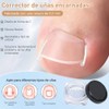 LUSCOR Kit Para Uñas Enterradas,Professional Ingrown Toenail Set,Pegatinas Para Uñas,