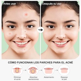 Pimple Patches 720 Parches, Parches para Acne Hidrocoloides, 2 Tamaños, Parches Anti-Espinillas Transparentes para Granos y Manchas, Tratamiento para 
