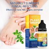 Sefudun Natural Plant Drops for Nails Care Tea Tree and